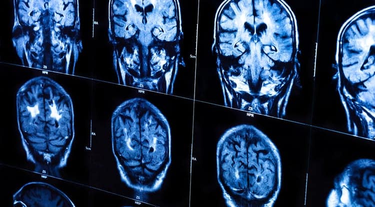 biomed imaging of the brain
